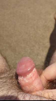 Smegma requested video 🦴🧀 