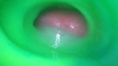 Inside View just filling my toy 